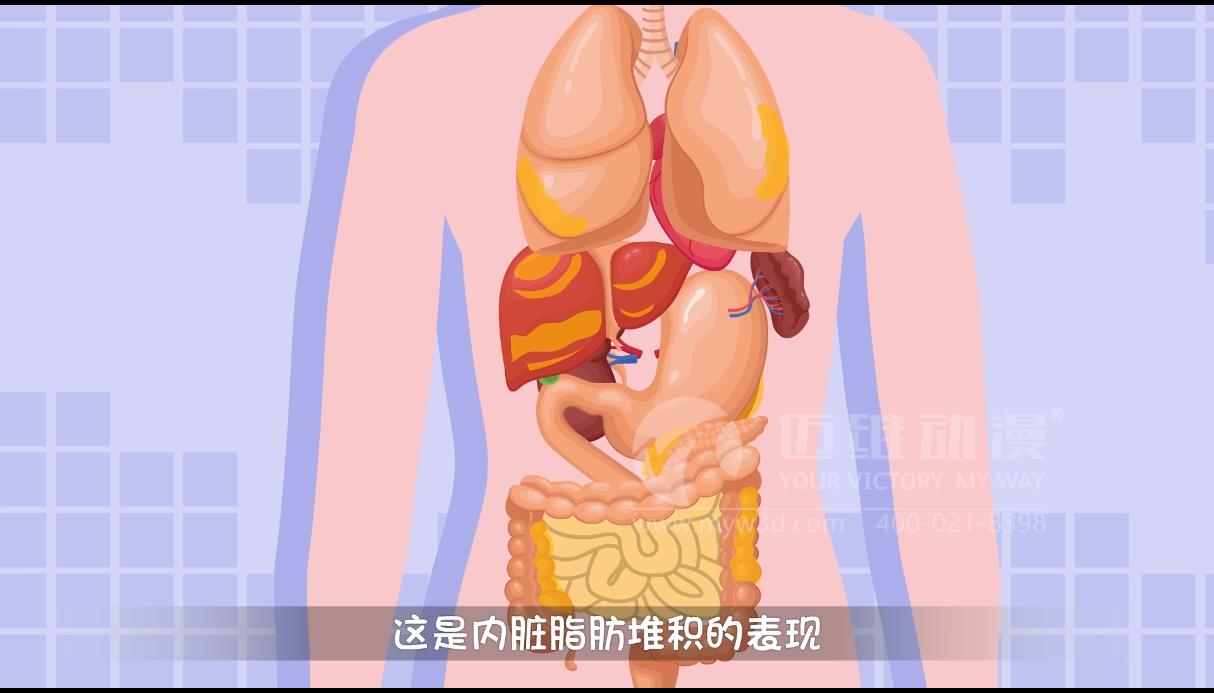 MG動畫，邁維動漫.jpg