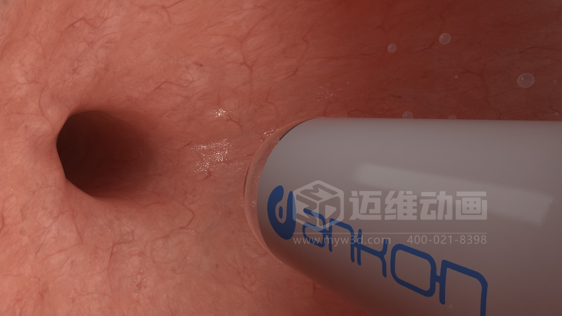 醫(yī)學(xué)檢測設(shè)備如何突破消化道檢查壁壘？三維動畫還原核心技術(shù)與臨床價值(圖4)